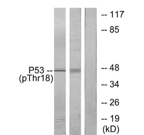 Western Blot - Anti-p53 (phospho Thr18) Antibody (A7187) - Antibodies.com