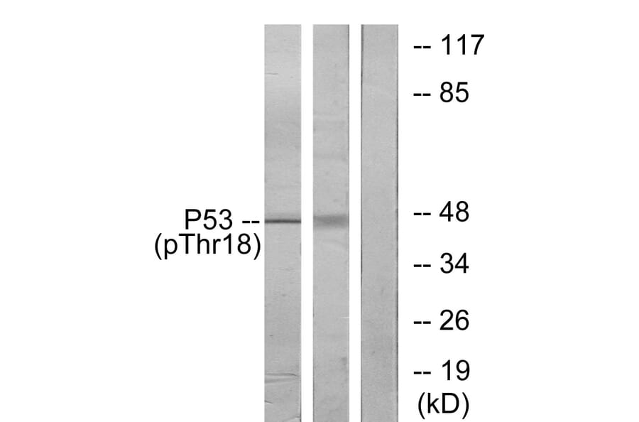 Western Blot - Anti-p53 (phospho Thr18) Antibody (A7187) - Antibodies.com