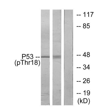 Western Blot - Anti-p53 (phospho Thr18) Antibody (A7187) - Antibodies.com