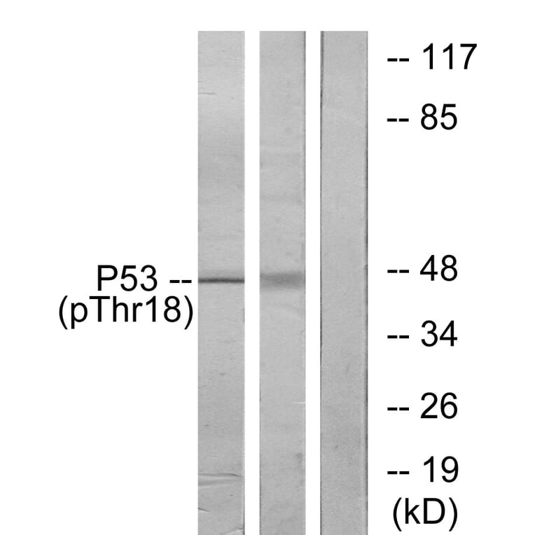 Western Blot - Anti-p53 (phospho Thr18) Antibody (A7187) - Antibodies.com
