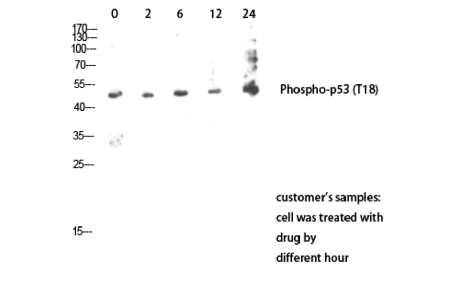 Western Blot - Anti-p53 (phospho Thr18) Antibody (A7187) - Antibodies.com