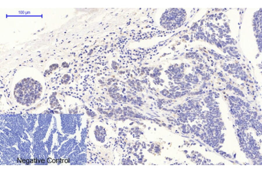 Immunohistochemistry - Anti-p53 (phospho Thr18) Antibody (A7187) - Antibodies.com
