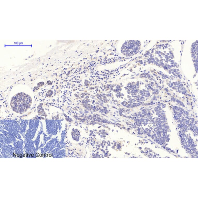 Immunohistochemistry - Anti-p53 (phospho Thr18) Antibody (A7187) - Antibodies.com