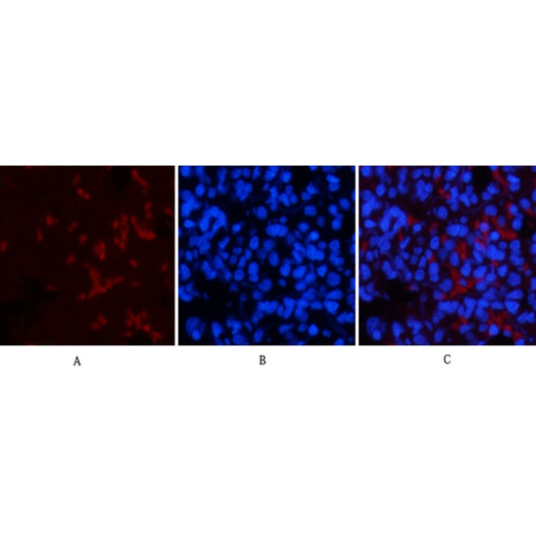 Immunofluorescence - Anti-p53 (phospho Thr18) Antibody (A7187) - Antibodies.com