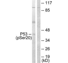 Western Blot - Anti-p53 (phospho Ser20) Antibody (A0529) - Antibodies.com