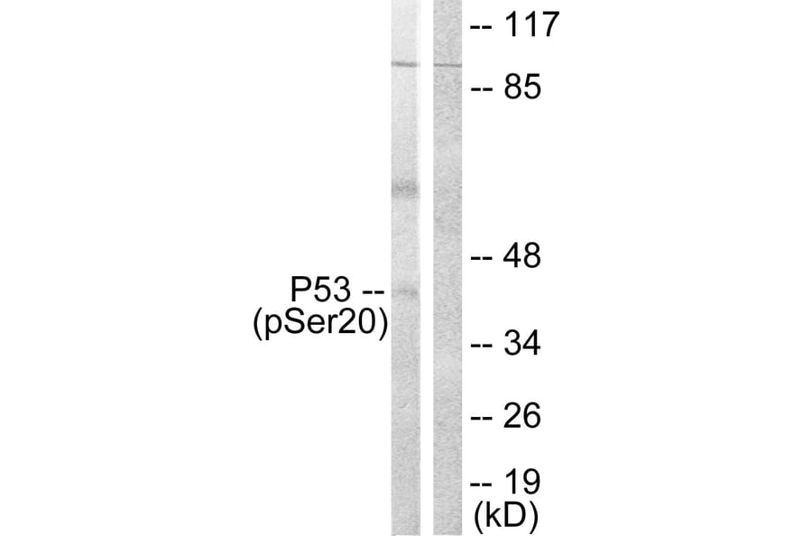 Western Blot - Anti-p53 (phospho Ser20) Antibody (A0529) - Antibodies.com
