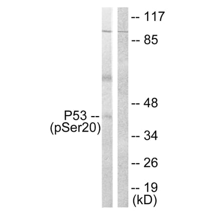 Western Blot - Anti-p53 (phospho Ser20) Antibody (A0529) - Antibodies.com