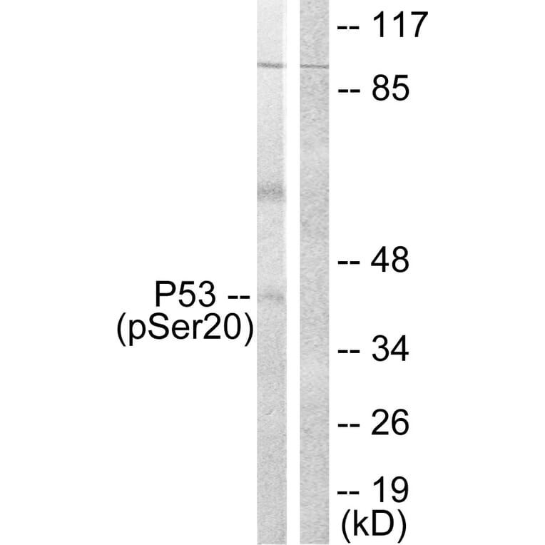 Western Blot - Anti-p53 (phospho Ser20) Antibody (A0529) - Antibodies.com