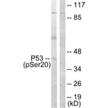 Western Blot - Anti-p53 (phospho Ser20) Antibody (A0529) - Antibodies.com