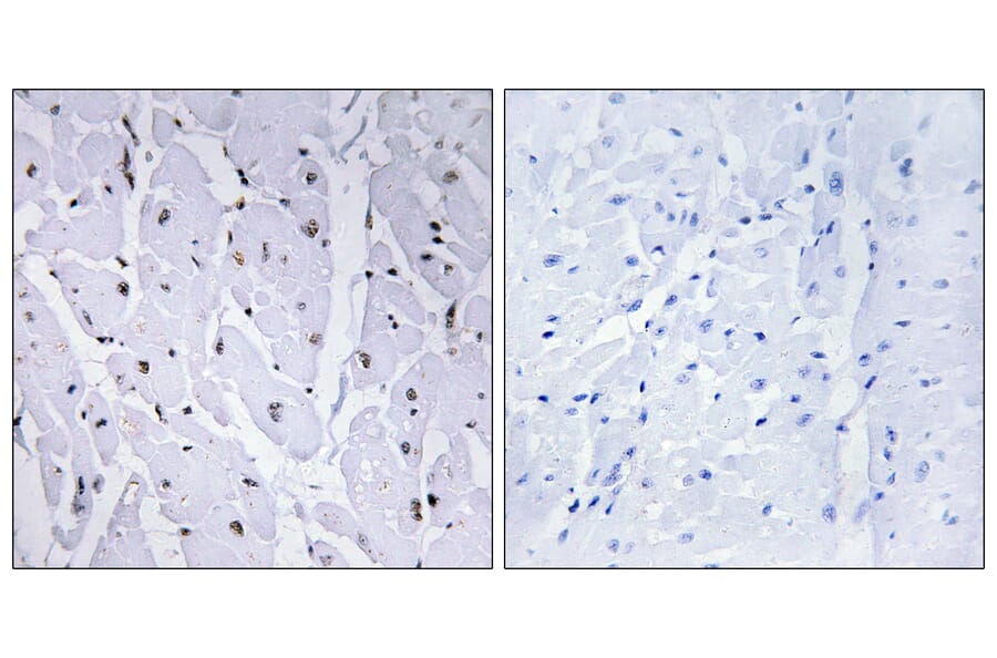 Immunohistochemistry - Anti-MYB (phospho Ser12) Antibody (A0515) - Antibodies.com