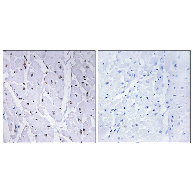 Immunohistochemistry - Anti-MYB (phospho Ser12) Antibody (A0515) - Antibodies.com