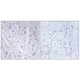 Immunohistochemistry - Anti-MYB (phospho Ser12) Antibody (A0515) - Antibodies.com