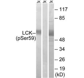 Western Blot - Anti-LCK (phospho Ser59) Antibody (A8215) - Antibodies.com