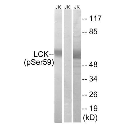 Western Blot - Anti-LCK (phospho Ser59) Antibody (A8215) - Antibodies.com