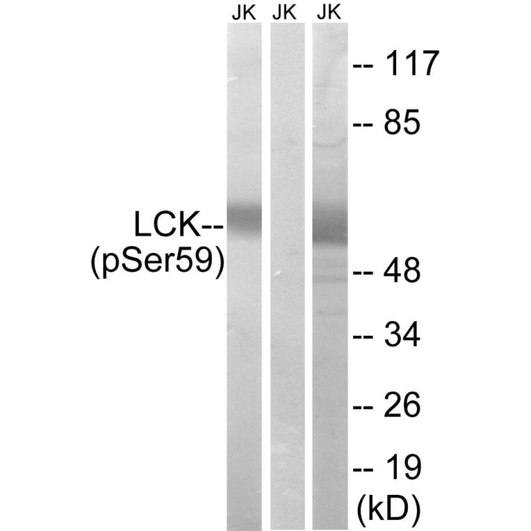 Western Blot - Anti-LCK (phospho Ser59) Antibody (A8215) - Antibodies.com