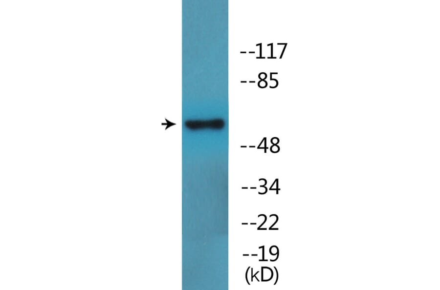 Western Blot - Anti-LCK (phospho Ser59) Antibody (P12-1134) - Antibodies.com