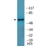 Western Blot - Anti-LCK (phospho Ser59) Antibody (P12-1134) - Antibodies.com