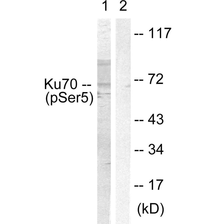 Western Blot - Anti-Ku70 (phospho Ser5) Antibody (A0449) - Antibodies.com