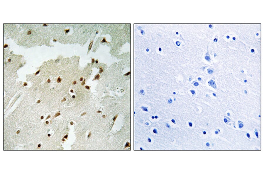 Immunohistochemistry - Anti-Ku70 (phospho Ser5) Antibody (A0449) - Antibodies.com