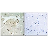 Immunohistochemistry - Anti-Ku70 (phospho Ser5) Antibody (A0449) - Antibodies.com