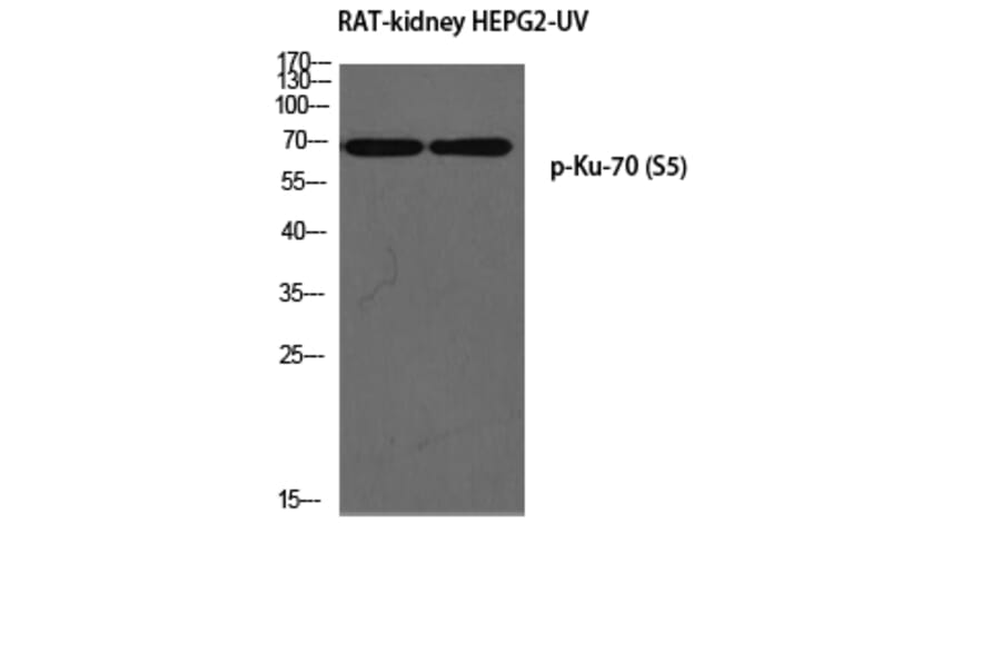 Western Blot - Anti-Ku70 (phospho Ser5) Antibody (A0449) - Antibodies.com