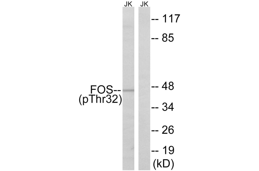 Western Blot - Anti-FOS (phospho Ser32) Antibody (A8212) - Antibodies.com