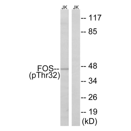 Western Blot - Anti-FOS (phospho Ser32) Antibody (A8212) - Antibodies.com