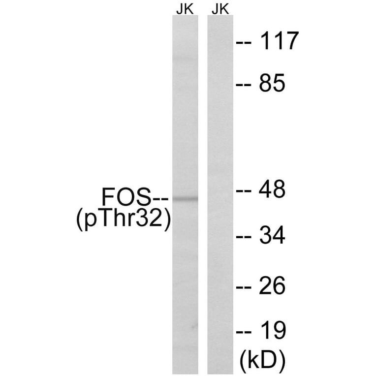 Western Blot - Anti-FOS (phospho Ser32) Antibody (A8212) - Antibodies.com