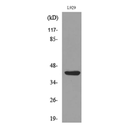 Western Blot - Anti-E2F4 (acetyl Lys96) Antibody (D12062) - Antibodies.com