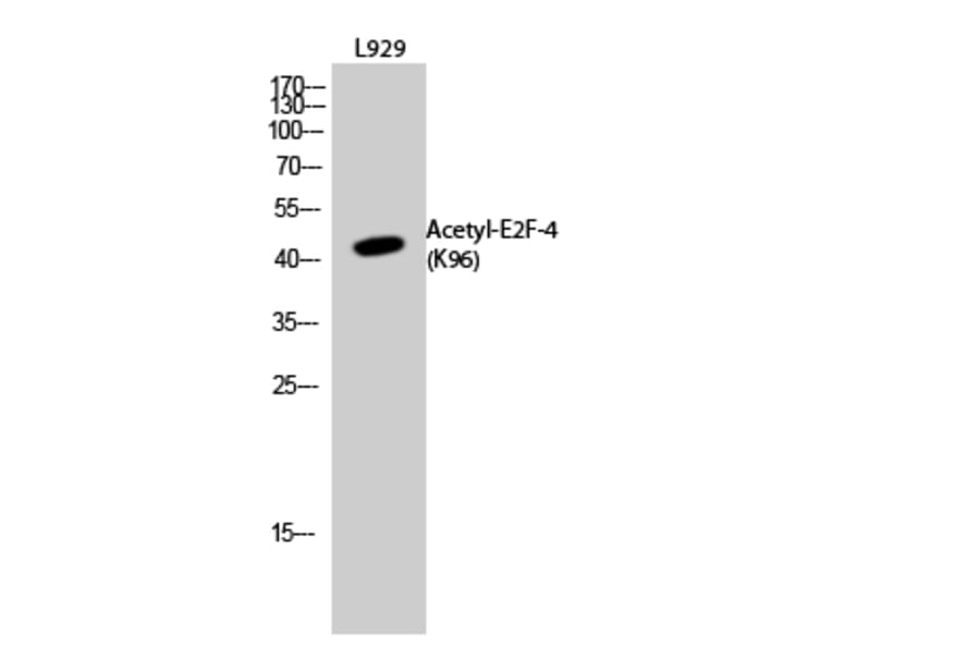 Western Blot - Anti-E2F4 (acetyl Lys96) Antibody (D12062) - Antibodies.com
