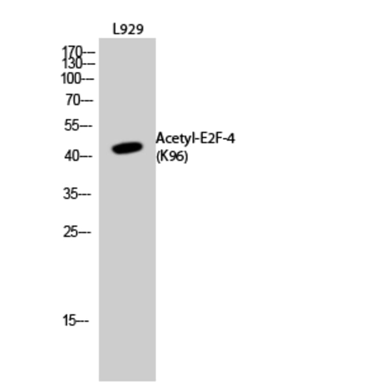 Western Blot - Anti-E2F4 (acetyl Lys96) Antibody (D12062) - Antibodies.com