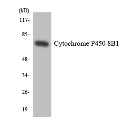 Western Blot - Anti-Cytochrome P450 8B1 Antibody (R12-2685) - Antibodies.com