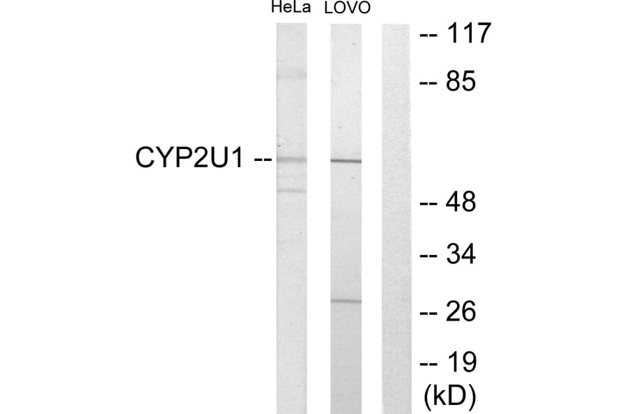 Western Blot - Anti-Cytochrome P450 2U1 Antibody (C12272) - Antibodies.com