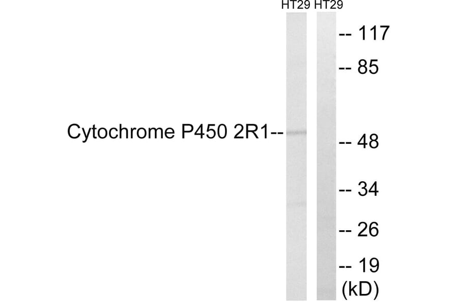 Western Blot - Anti-Cytochrome P450 2R1 Antibody (C12270) - Antibodies.com