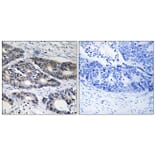 Immunohistochemistry - Anti-Cytochrome P450 2R1 Antibody (C12270) - Antibodies.com