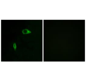 Immunofluorescence - Anti-Collagen XIV alpha1 Antibody (C12218) - Antibodies.com