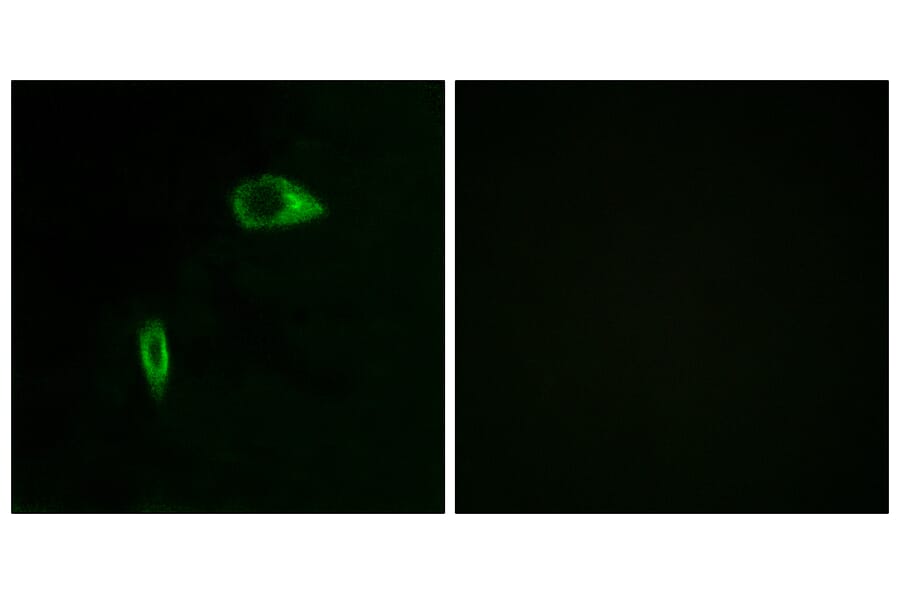 Immunofluorescence - Anti-Collagen XIV alpha1 Antibody (C12218) - Antibodies.com