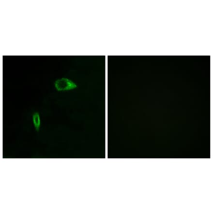 Immunofluorescence - Anti-Collagen XIV alpha1 Antibody (C12218) - Antibodies.com