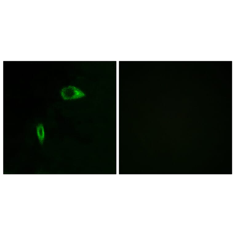 Immunofluorescence - Anti-Collagen XIV alpha1 Antibody (C12218) - Antibodies.com