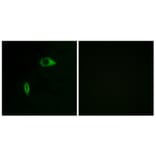 Immunofluorescence - Anti-Collagen XIV alpha1 Antibody (C12218) - Antibodies.com