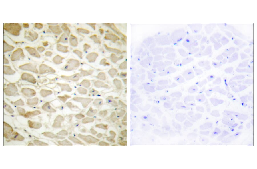 Immunohistochemistry - Anti-Collagen XIV alpha1 Antibody (C12218) - Antibodies.com
