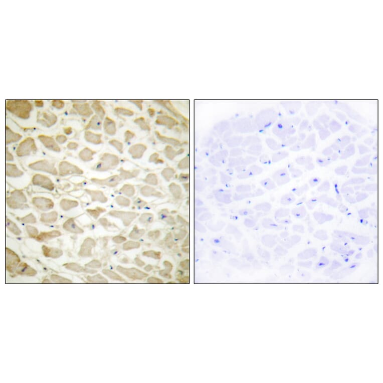 Immunohistochemistry - Anti-Collagen XIV alpha1 Antibody (C12218) - Antibodies.com