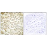 Immunohistochemistry - Anti-Collagen XIV alpha1 Antibody (C12218) - Antibodies.com