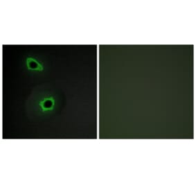 Immunofluorescence - Anti-Collagen VII alpha1 Antibody (C12207) - Antibodies.com