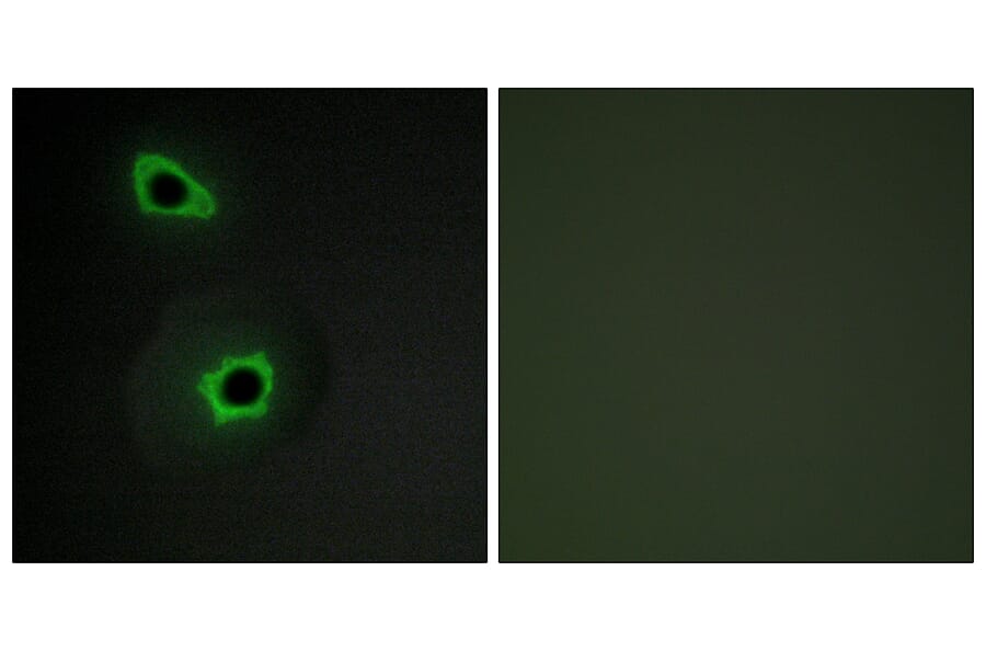 Immunofluorescence - Anti-Collagen VII alpha1 Antibody (C12207) - Antibodies.com