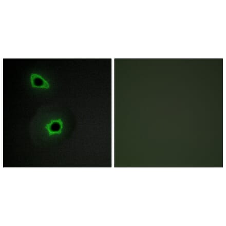Immunofluorescence - Anti-Collagen VII alpha1 Antibody (C12207) - Antibodies.com