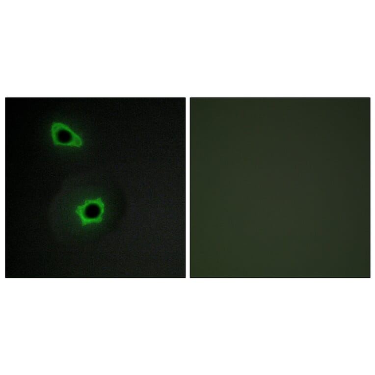 Immunofluorescence - Anti-Collagen VII alpha1 Antibody (C12207) - Antibodies.com