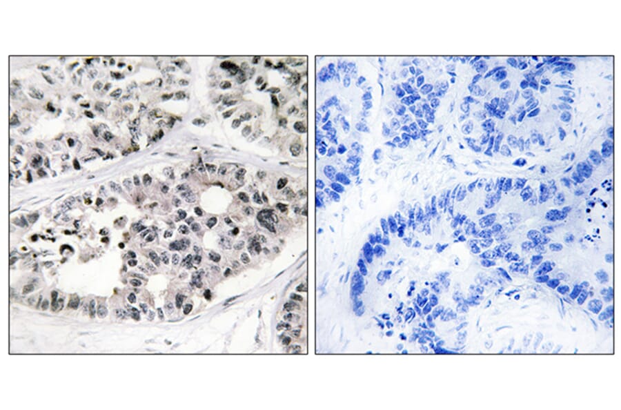 Immunohistochemistry - Anti-Collagen VII alpha1 Antibody (C12207) - Antibodies.com