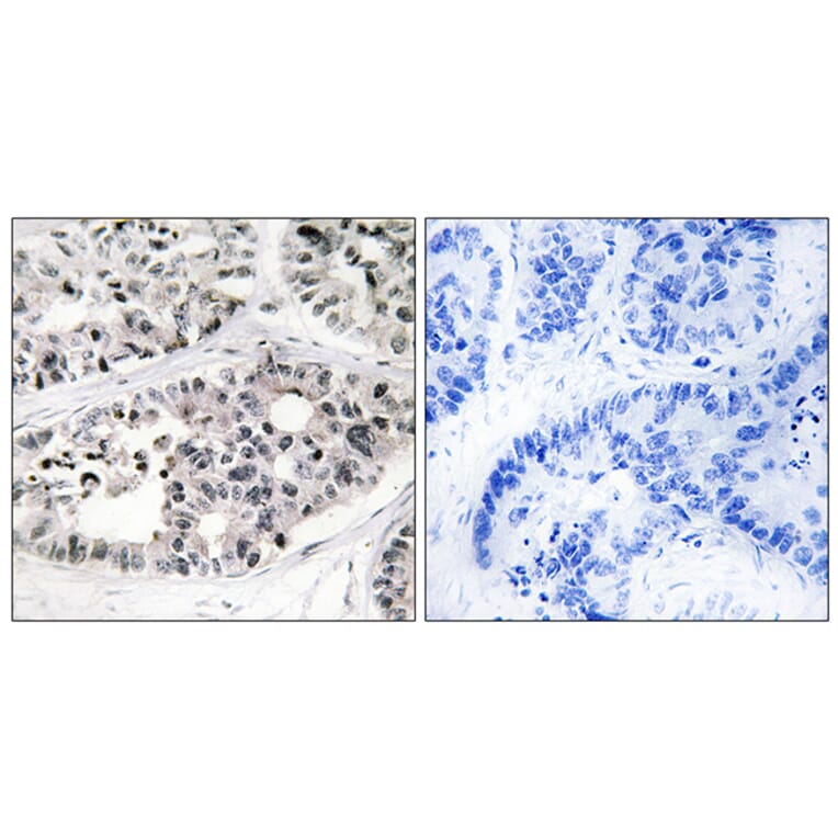 Immunohistochemistry - Anti-Collagen VII alpha1 Antibody (C12207) - Antibodies.com