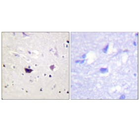 Immunohistochemistry - Anti-PAK1 + PAK2 + PAK3 Antibody (B0541) - Antibodies.com